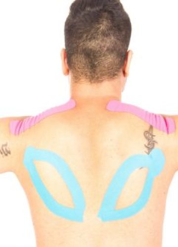 קניזיולוגיה טייפינג